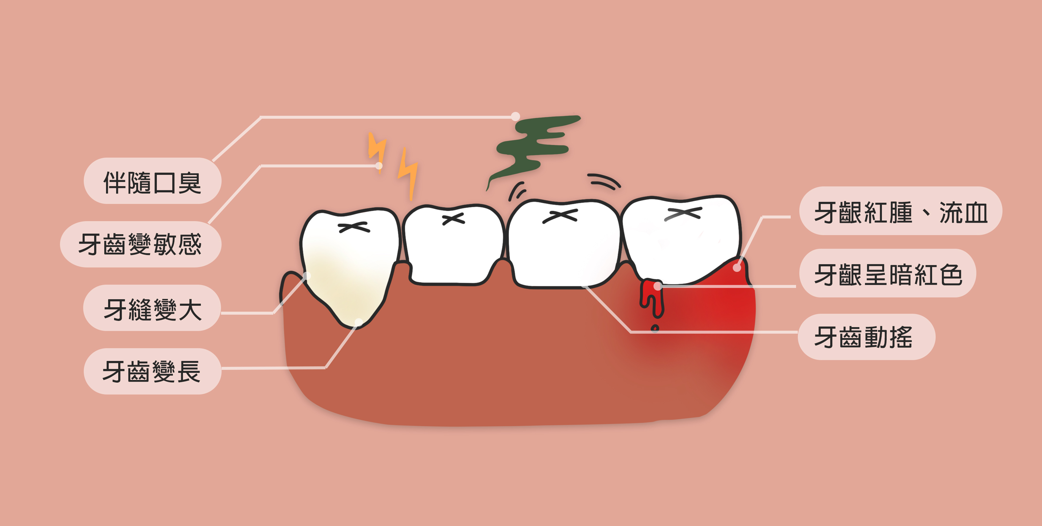 牙周病综合症牙周病治疗前牙龈充血红肿明显_图片_互动百科