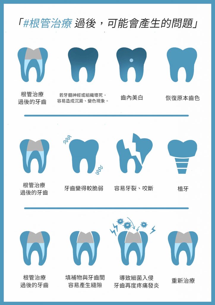 根管治療後,可能會產生的問題