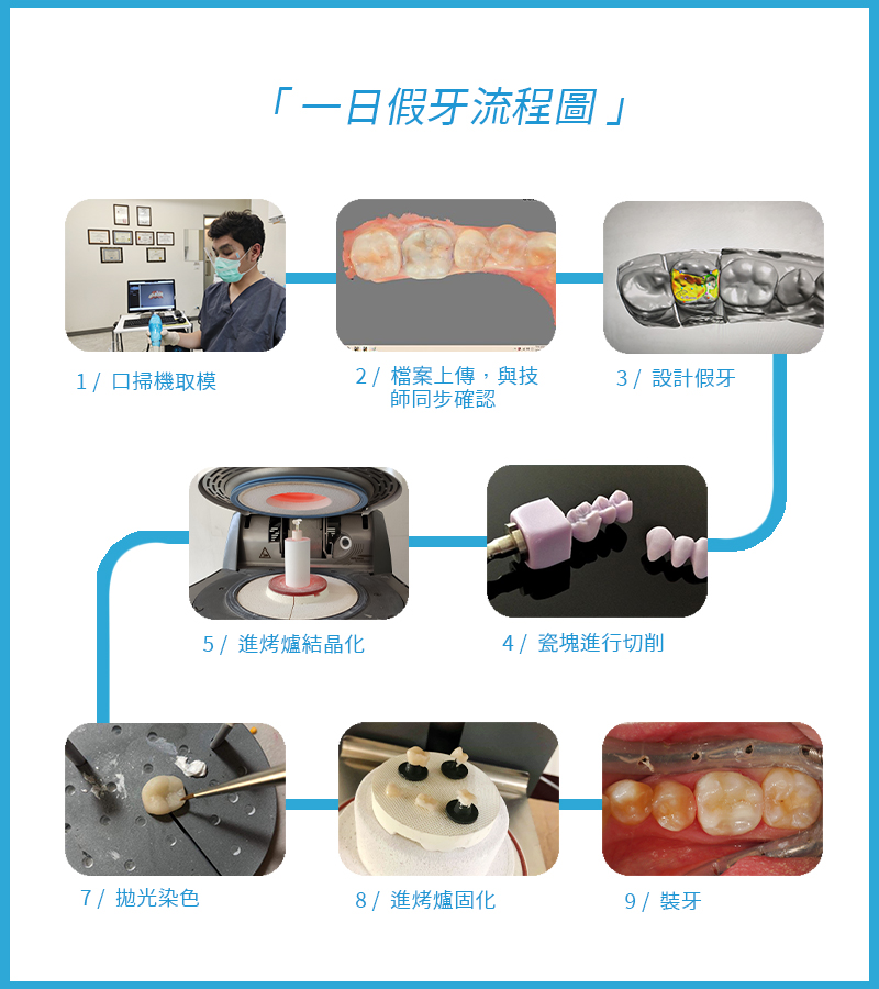 假牙推薦