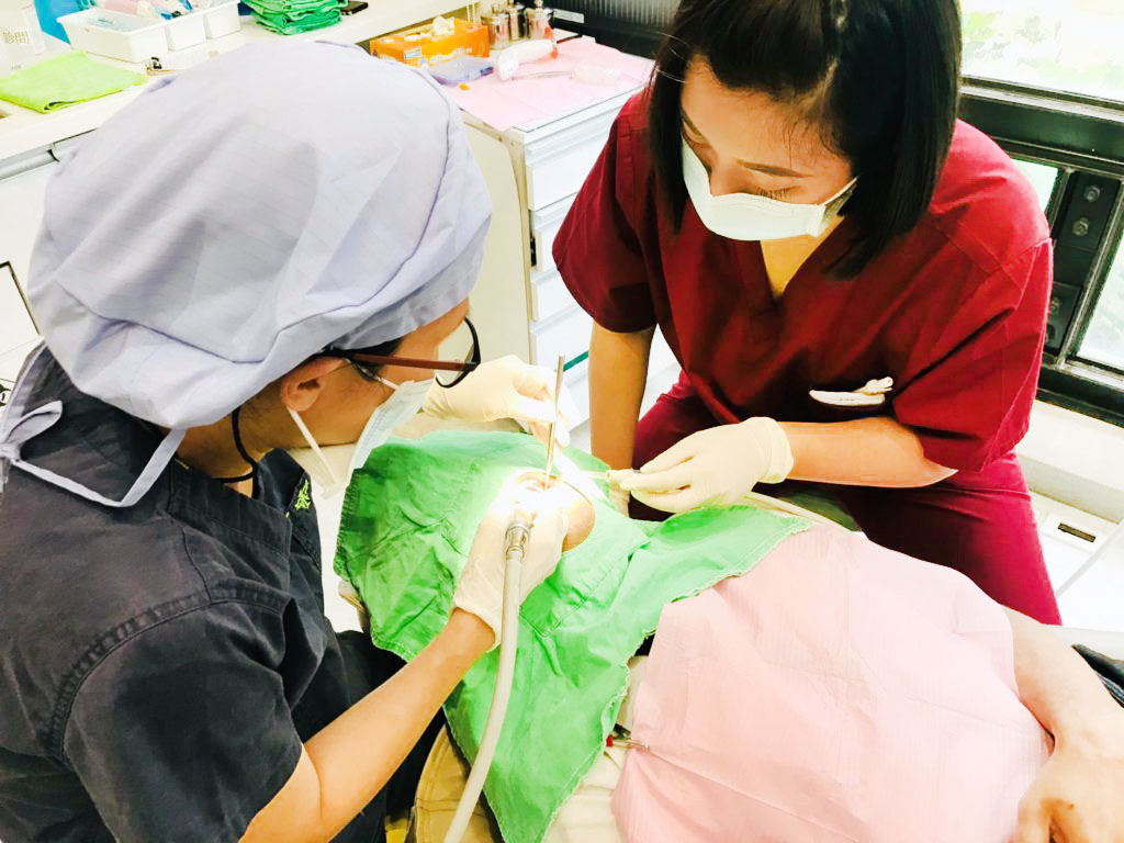 洗牙示意圖