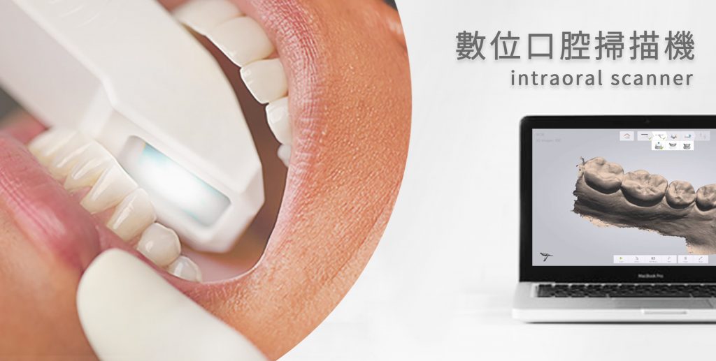 新竹植牙數位口腔掃描機