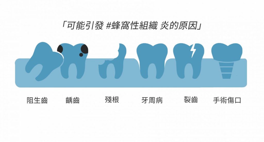 引發蜂窩性組織炎的原因
