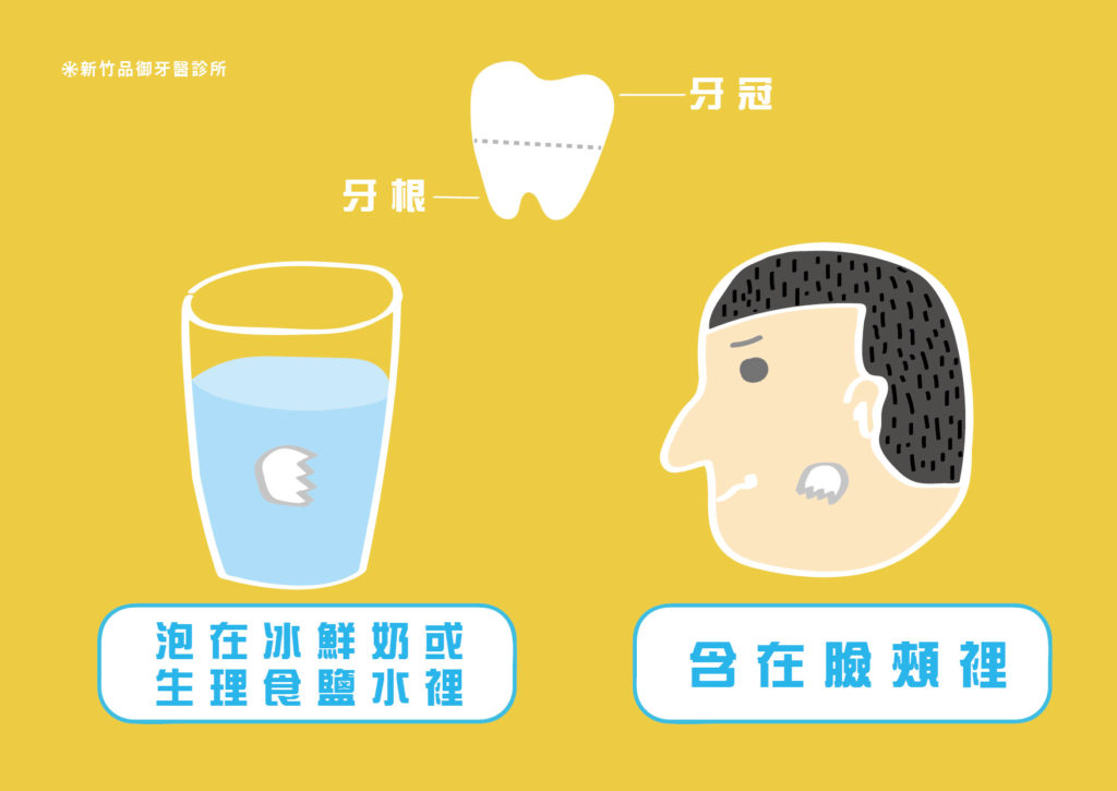 牙齒斷裂的兩種處理方式