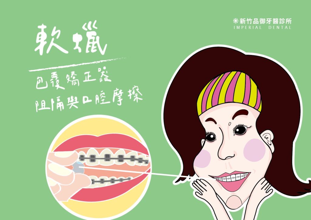 金屬矯正器刮傷包蠟