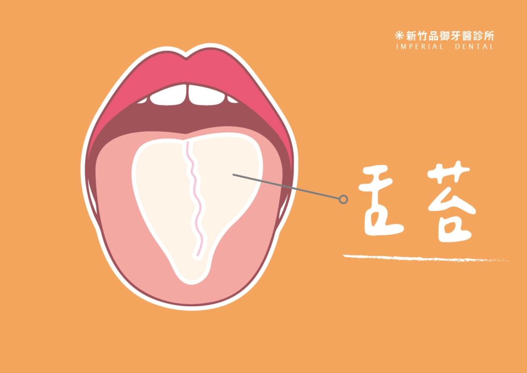 舌苔
