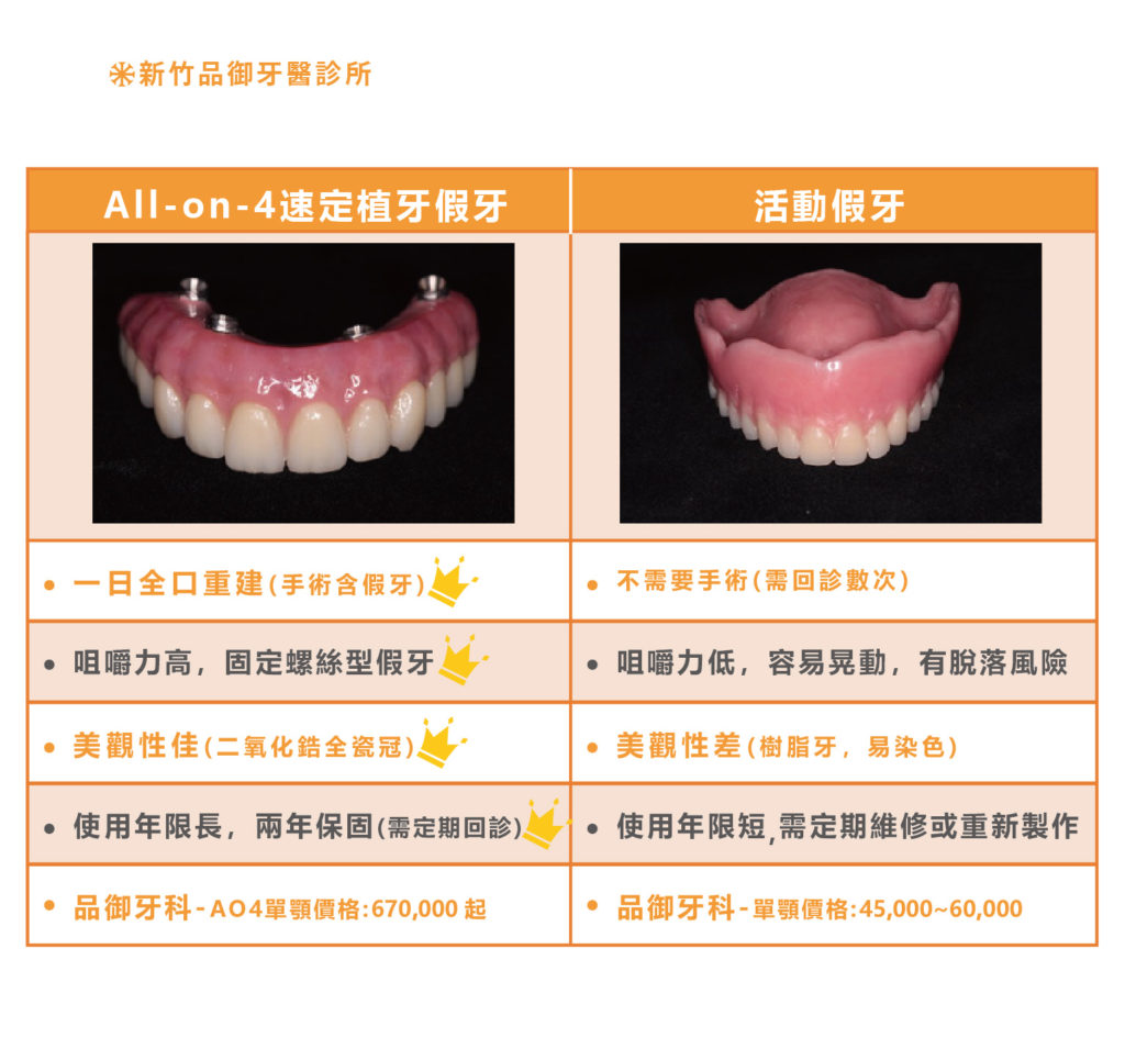 全口植牙與活動假牙比較表格
