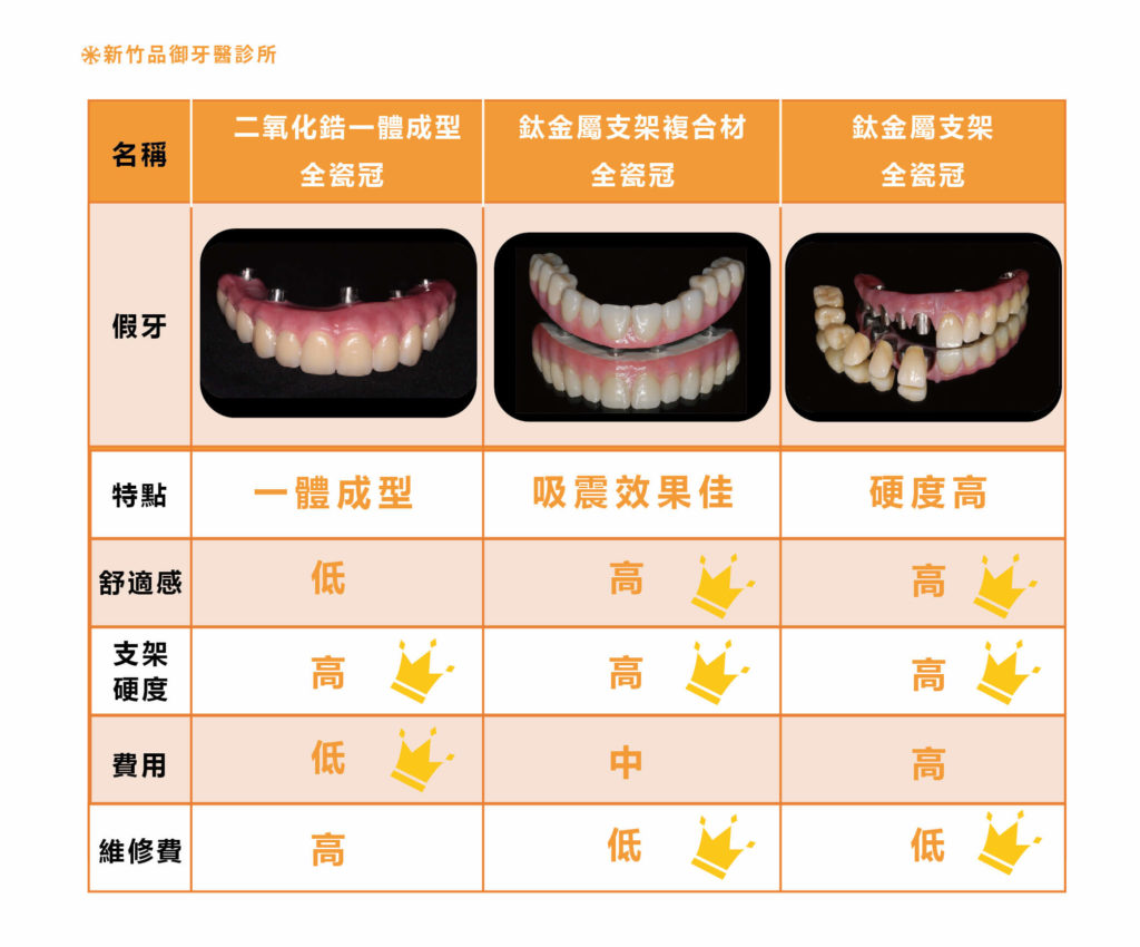 三種All on 4 植牙的假牙材質比較表格