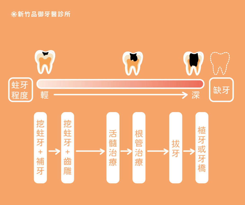 輕度蛀牙到深度蛀牙